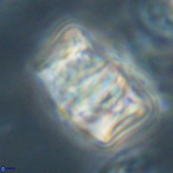 Chiphragmalithus calathus VR 30333