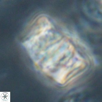 Chiphragmalithus calathus VR 30333