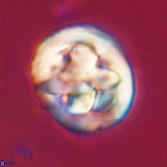 Chiphragmalithus calathus VR 30345