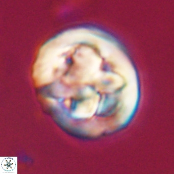 Chiphragmalithus calathus VR 30345