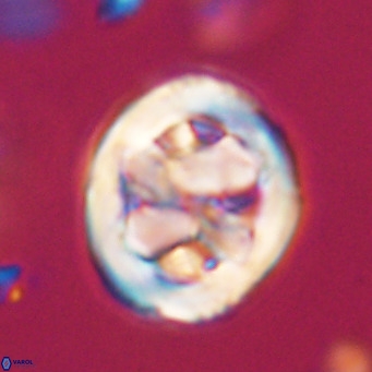 Chiphragmalithus calathus VR 30346