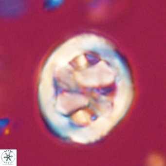 Chiphragmalithus calathus VR 30346