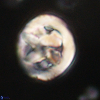 Chiphragmalithus calathus VR 30347