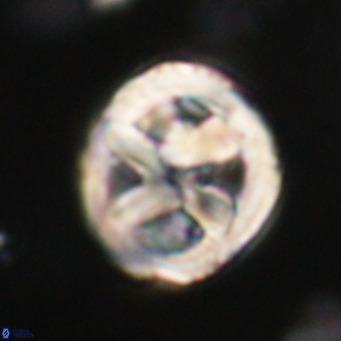 Chiphragmalithus calathus VR 30348