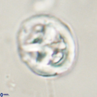 Chiphragmalithus calathus VR 30340