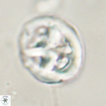 Chiphragmalithus calathus VR 30340