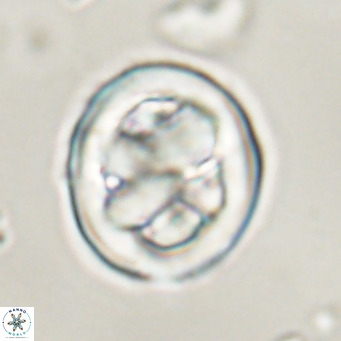 Chiphragmalithus calathus VR 30341