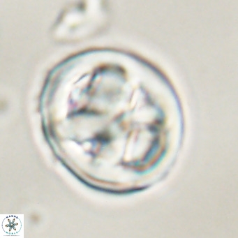 Chiphragmalithus calathus VR 30342