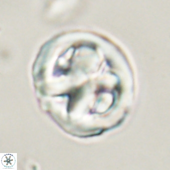 Chiphragmalithus calathus VR 30343