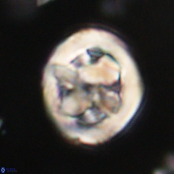 Chiphragmalithus calathus VR 30354