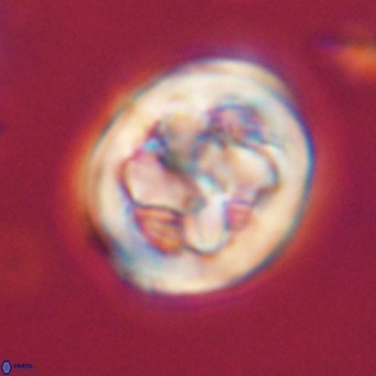 Chiphragmalithus calathus VR 30350
