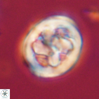 Chiphragmalithus calathus VR 30350