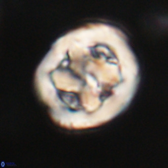 Chiphragmalithus calathus VR 30351