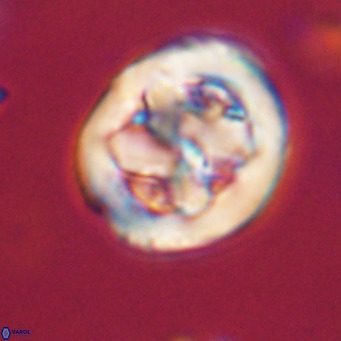 Chiphragmalithus calathus VR 30352