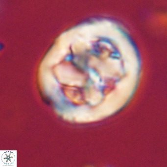Chiphragmalithus calathus VR 30352
