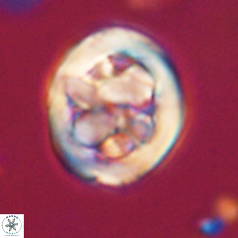 Chiphragmalithus calathus VR 30353