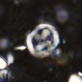 Chiphragmalithus calatus 49077