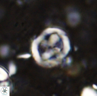 Chiphragmalithus calatus 49077