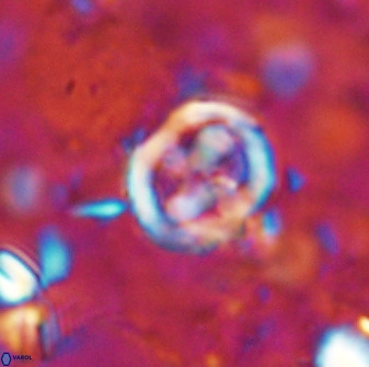 Chiphragmalithus calatus 49078