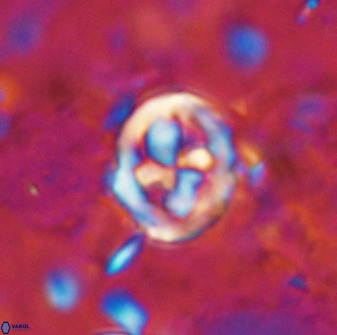 Chiphragmalithus calatus 49080