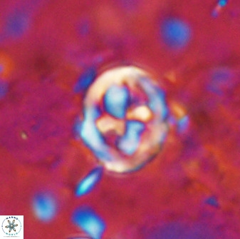 Chiphragmalithus calatus 49080