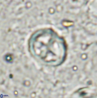 Chiphragmalithus calatus 49083