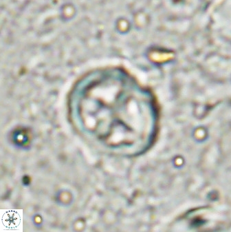Chiphragmalithus calatus 49083