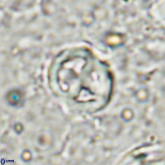 Chiphragmalithus calatus 49084