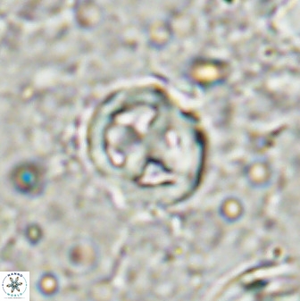 Chiphragmalithus calatus 49084