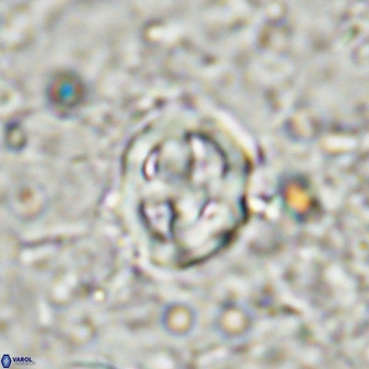 Chiphragmalithus calatus 49085
