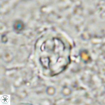 Chiphragmalithus calatus 49085
