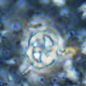 Chiphragmalithus calatus 49087