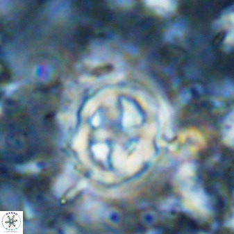Chiphragmalithus acanthodes 9087