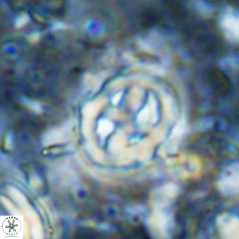 Chiphragmalithus calatus 49088