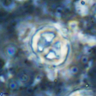 Chiphragmalithus calatus 49089