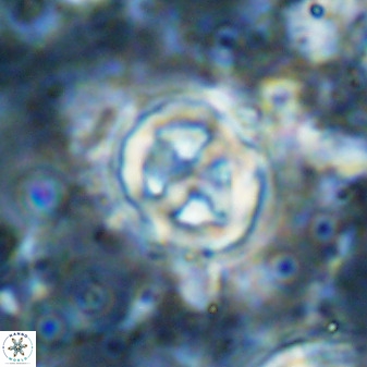 Chiphragmalithus calatus 49089