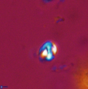 Conusphaera maledicto 19402