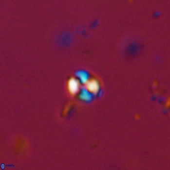 Conusphaera maledicto 19103