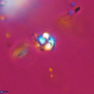 Conusphaera maledicto 19214