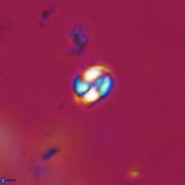 Conusphaera maledicto 19236