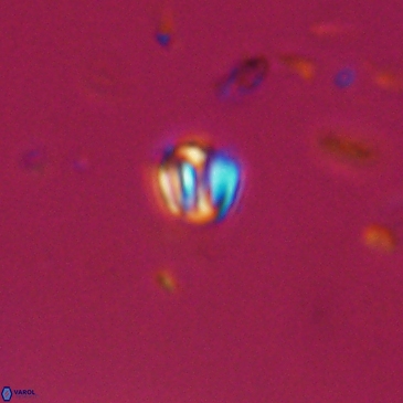 Conusphaera maledicto 19241