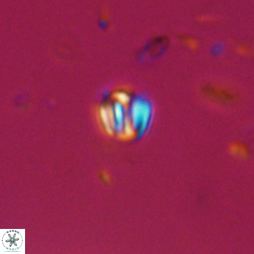 Conusphaera maledicto 19241