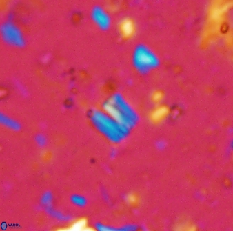 Conusphaera maledicto 33237