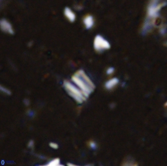 Conusphaera maledicto 33238