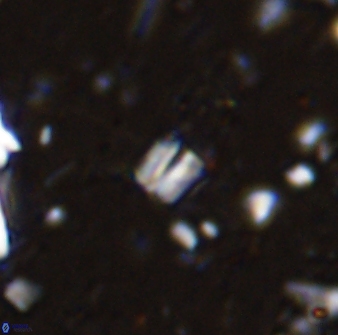 Conusphaera maledicto 33240