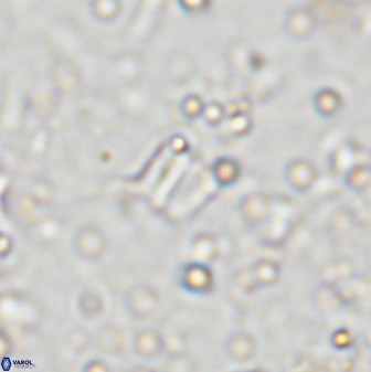 Conusphaera maledicto 33241