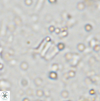 Conusphaera maledicto 33241