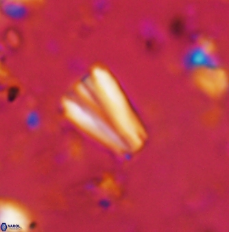 Conusphaera mexicana mexicana 1381