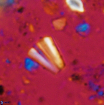 Conusphaera mexicana mexicana 1400