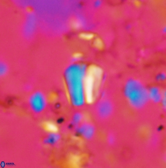 Conusphaera mexicana minor 1383